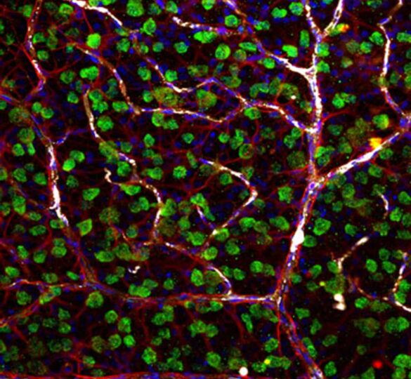 Scientists Discover New Potential Glaucoma Treatment