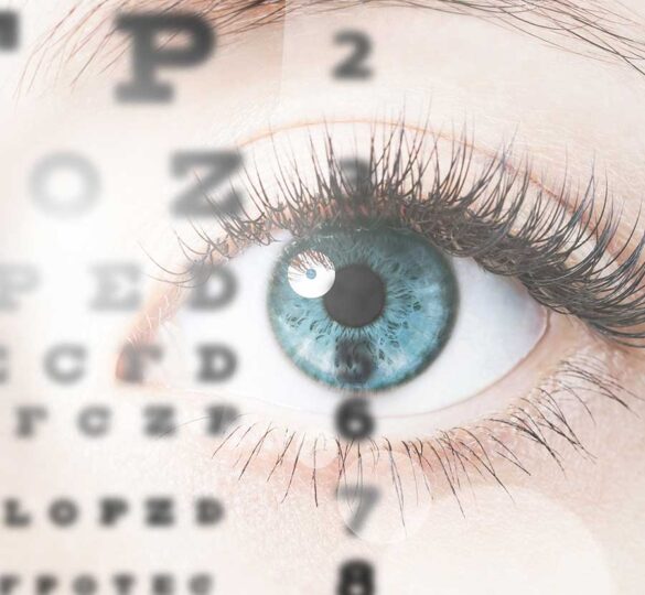 Glaucoma Y Capacidad De Lectura