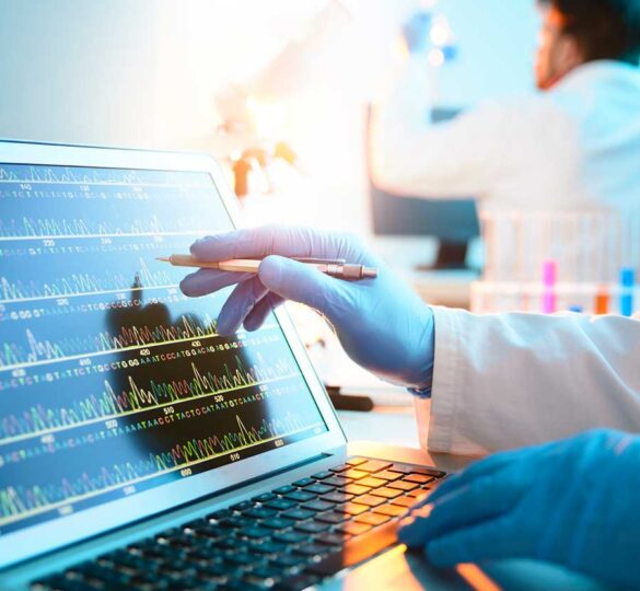 Genetic Testing In Glaucoma